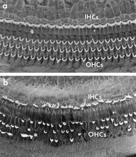 Dead Cells Ears Hair