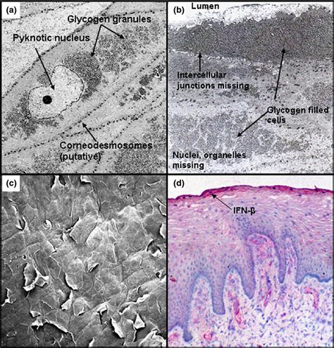 The Structure Of The Human Vaginal Stratum Corneum And Its Role In