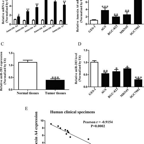 The Levels Of Annexin A4 And MiR 203 In Gastric Cancer GC Tissues And