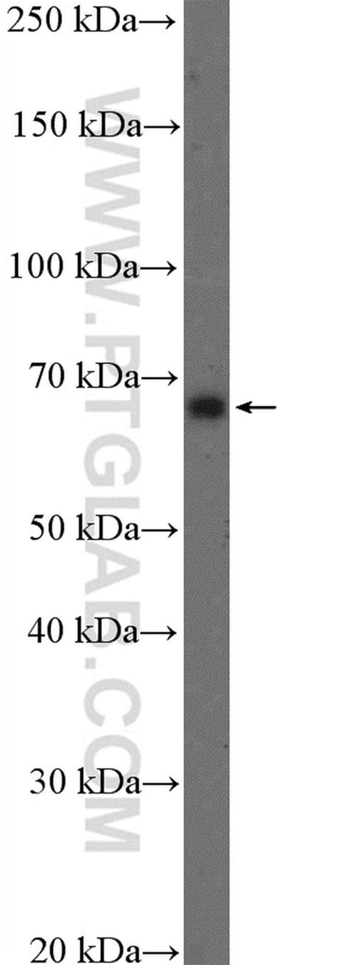 Gad1 Rabbit Anti Human Mouse Rat Polyclonal Proteintech 150 μl