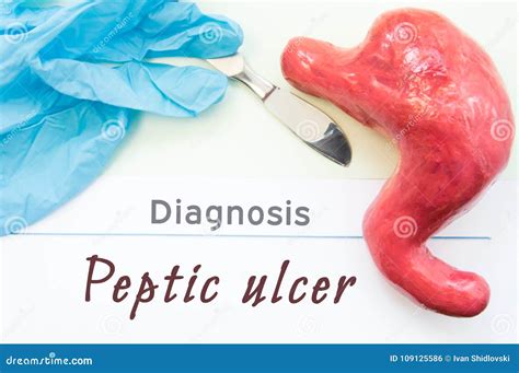 Diagnosis Of Peptic Ulcer Figure Stomach Scalpel And Surgical Gloves