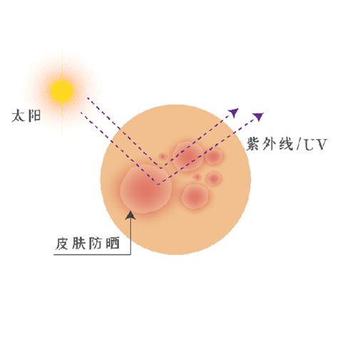 你真的了解紫外线吗？带你看看它的“嚣张”世界！ 辟谣课堂 开封市互联网辟谣平台