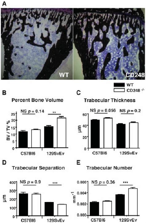 Cd Deficient Mice Have Increased Trabecular Bone Volume A The