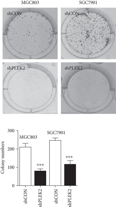 Knockdown Of Plek2 Significantly Suppressed Gastric Cancer Cell