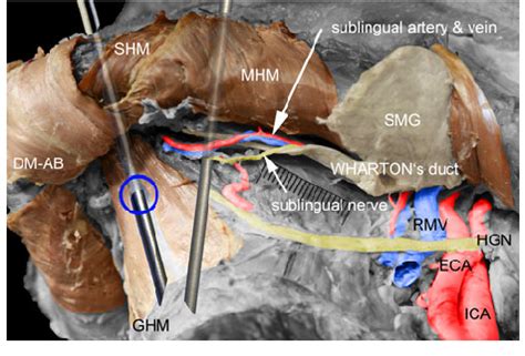 Muscles Of Floor Of Mouth Ct Anatomy Quiz - Infoupdate.org