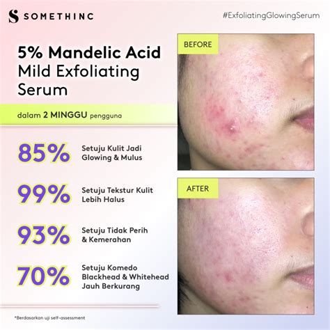 Somethinc Mandelic Acid Mild Exfoliating Serum Ml