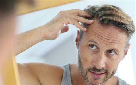 Hair Loss Treatment Leeds Prp Medifine Skin Clinic