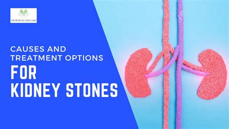 Causes and Treatment Options for Kidney Stones | Dr. Barun Kumar