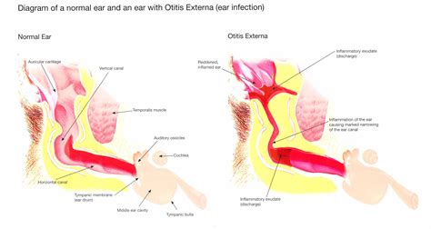 Otitis Media In Dogs