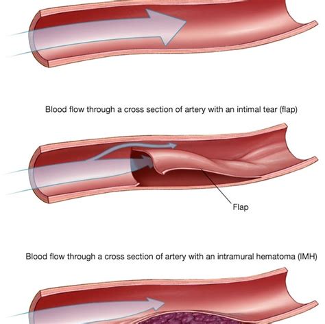 Jaw Pain and Heart Attack: Understanding the Connection and Symptoms