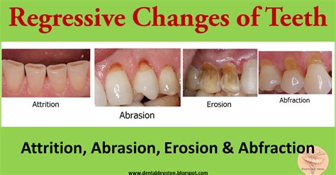 Dentosphere : World of Dentistry: Regressive changes in Tooth ...