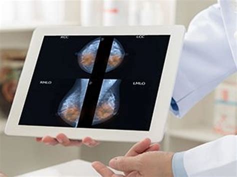 Breast Arterial Calcification On Mammography Tied To Cvd Risk Physician S Weekly