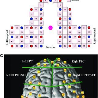 Channel Location On The Cortical Surface A Predicted Location Of