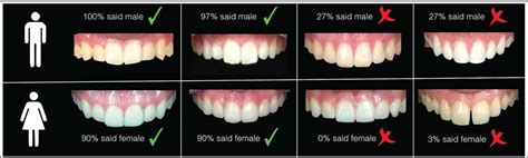 Prevalence Of Tooth Forms And Their Gender Correlation Semantic Scholar