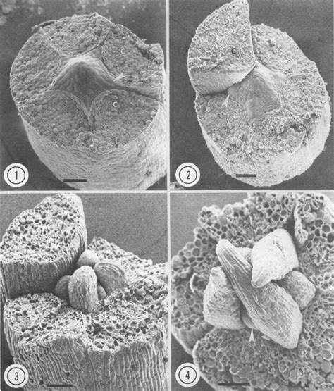 Figure From An Ultrastructural And Microspectrophotometric Study Of