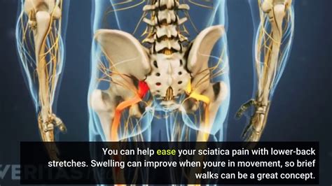 7 Simple Techniques For Sciatica And Pinched Nerve Symptoms And Treatment Medstar