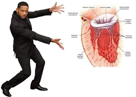 Estenose Mitral Tudo Que Voc Precisa Saber Medway