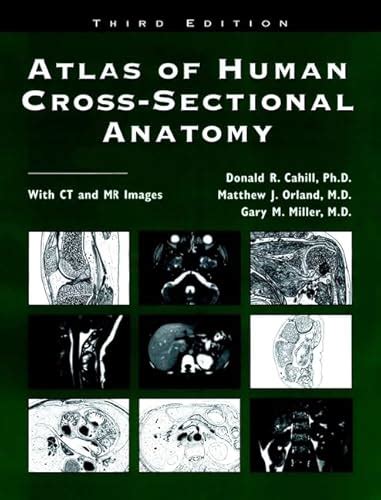 Atlas Of Human Cross Sectional Anatomy With Ct And Mr Images Cahill