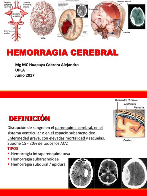 P4a 2017 6 8 Hemorragia Cerebral Pptx Especialidades Médicas