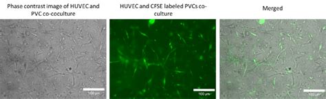 Co Culture Of Human Umbilical Cord Vein Endothelial Cells Huvec And