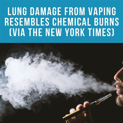 Lung Damage From Vaping Resembles Chemical Burns Report Says