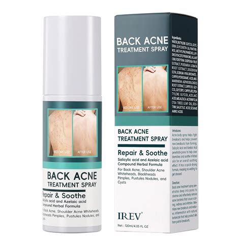 Amazon Back Acne Spray Salicylic Acid Spray Body Acne Spray Back