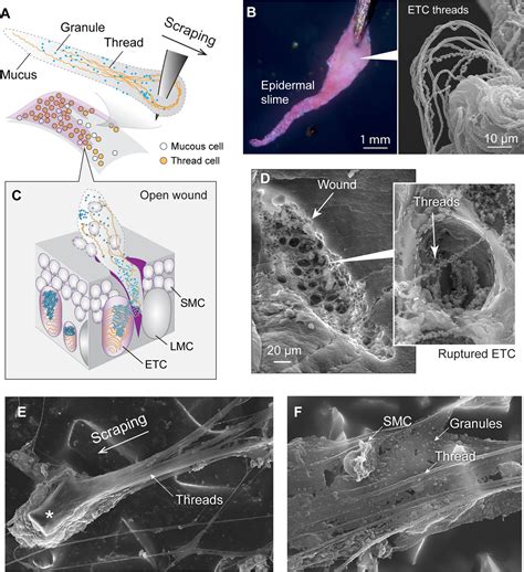 Figures And Data In Epidermal Threads Reveal The Origin Of Hagfish