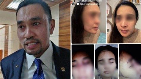 Kasus Putri Balqis Korban KDRT Jadi Tersangka Ahmad Sahroni Senggol