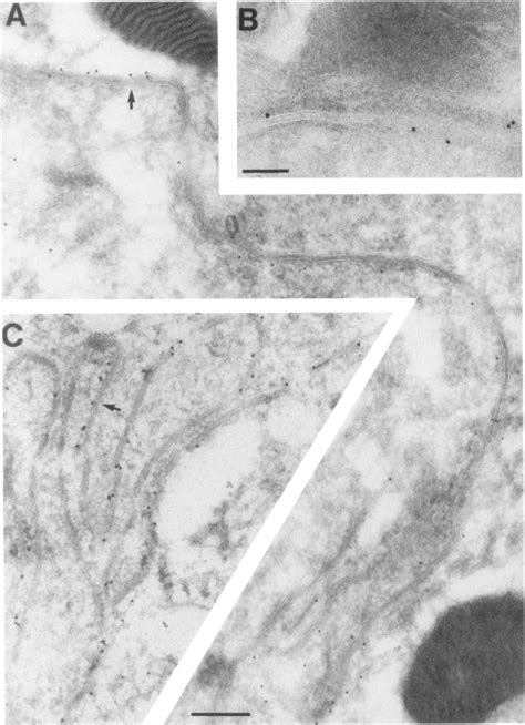 Figure 7 From The Drosophila Lethal 2 Giant Larvae Tumor Suppressor