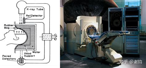 现代医学成像（3）——ct（基本原理与图像重建） 知乎