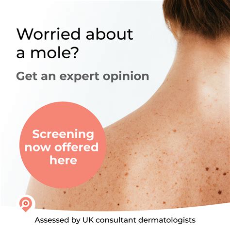 Mole Check Mole Examination Check Moles Beaconsfield