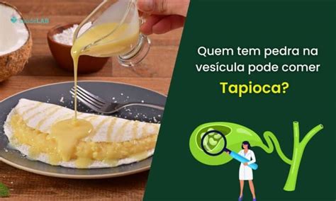 Quem Fez Cirurgia De Vesícula Pode Comer Tapioca - Quem tem pedra na vesícula pode comer tapioca? Clique aqui e descubra