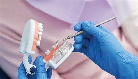 Dental Implant Care Essential Tips For A Long Lasting Confident Smile