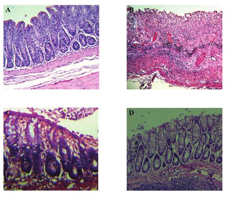 Histopathology Evaluation Of Colonic Tissue Of The Experimental Download Scientific Diagram