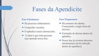 Apendicite PPT