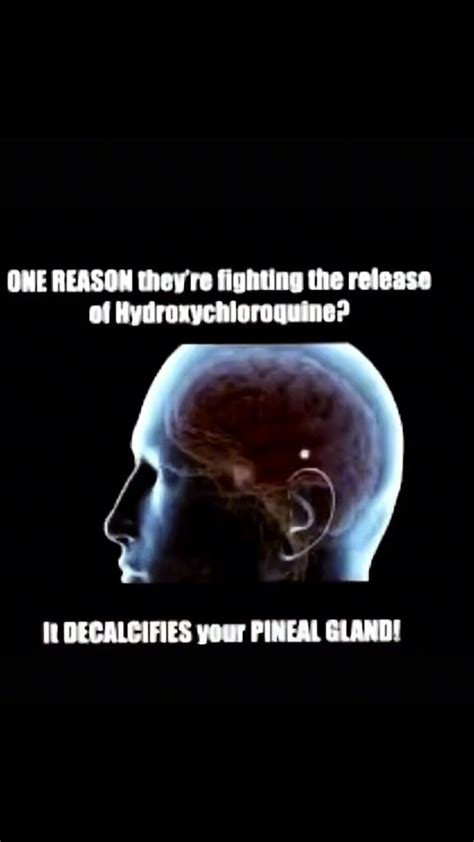 Un calcify the pineal gland