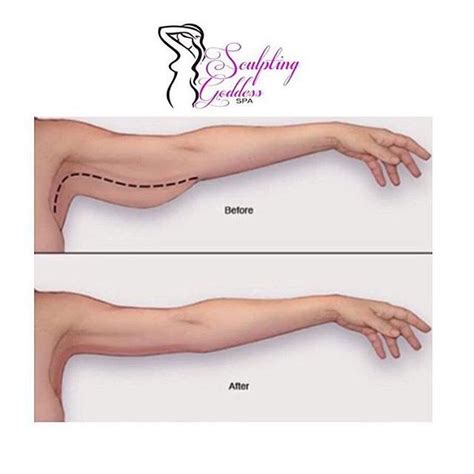 Ladies We Do Not Only Body Contour Your Stomach We Also Contour Your Arms Contour Makeup Body