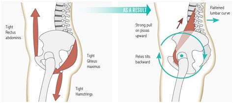 Pin on Psoas