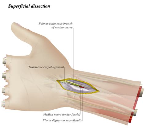 Volar Aspect Of Hand - Anatomy Of The Volar Forearm Part 1 - Everything You Need ... : When ...