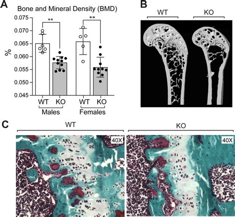 A Bone Mineral Density Bmd Assessed By Dual‐energy X‐ray Download Scientific Diagram