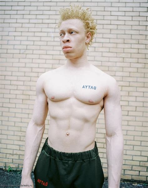 Albinism nude 62 фото