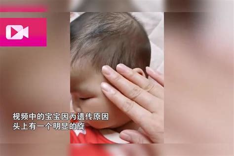 广西一女宝宝额头长发旋，妈妈担心：女孩子以后怎么留刘海