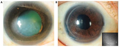 Ijms Free Full Text Corneal Endothelial Like Cells Derived From