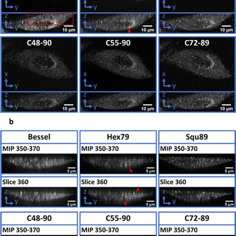 D Imaging Of Arpe Cells Labeled With Egfp Clathrin Light Chain A