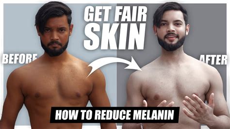 How To Reduce Melanin In Body Get Fair Skin YouTube