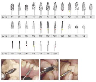 Premiere Dental: Carbide Burs