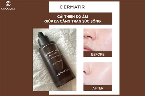 Review Tinh Chất Dermatir Rosemary Pure Ampoule Dưỡng Ẩm Ngừa Lão Hoá 50ml