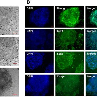 Differentiated Human IPS Cells Express Positive Retinal Ganglion Cell