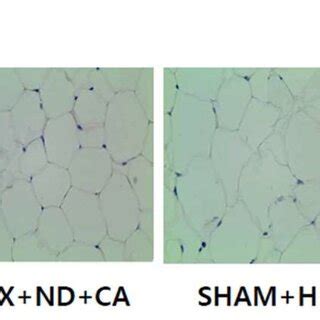 Effect Of CA On Adipocyte Morphology A And Size B The Adipose