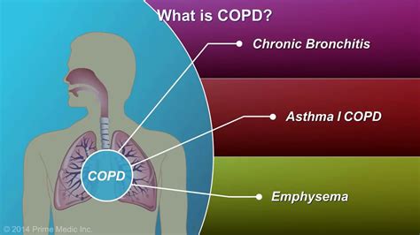 Understanding emphysema: Emphysema – Symptoms and causes